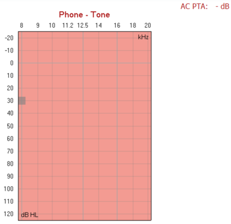 Inverted graph with dB HL as a function of kHz. The displayed frequency range is 8 kHz to 20 kHz. The displayed dB HL range is minus 20 dB HL to plus 120 dB HL.