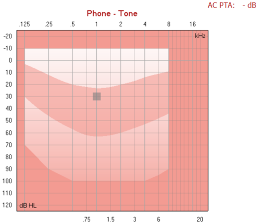 Inverted graph with dB HL as a function of kHz. The displayed frequency range is 0,125 kHz to 20 kHz. The displayed dB HL range is minus 20 dB HL to plus 120 dB HL.