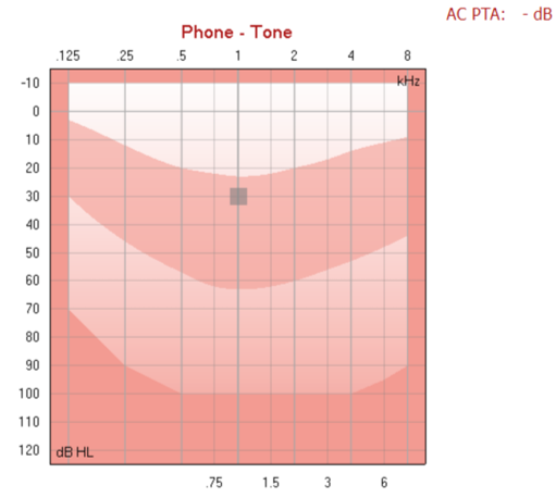 Inverted graph with dB HL as a function of kHz. The displayed frequency range is 0,125 kHz to 8 kHz. The displayed dB HL range is minus 10 dB HL to plus 120 dB HL.