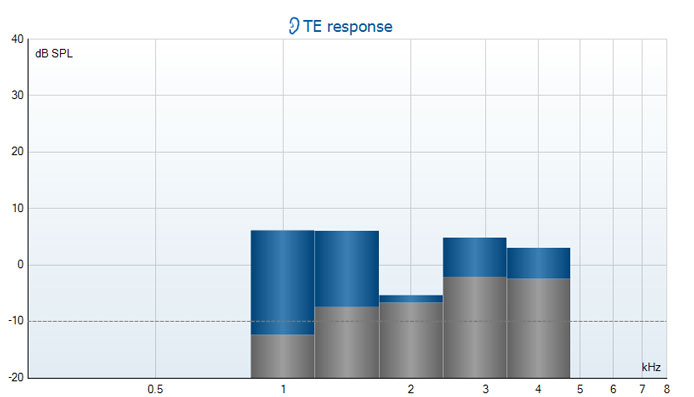 TE response graph with dB SPL as a function of kilohertz. The TEOAE responses range from minus 6 to plus 6 dB SPL.
