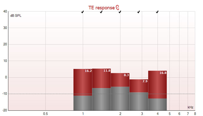 TE response graph with dB SPL as a function of kilohertz. The TEOAE responses range from minus 2 to plus 5 dB SPL, with signal-to-noise ratios between 7.9 to 16.8.