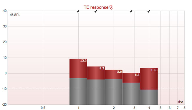 TE response graph with dB SPL as a function of kilohertz. The TEOAE responses range from zero to 10 dB SPL, with signal-to-noise ratios between 5.8 to 13.8.