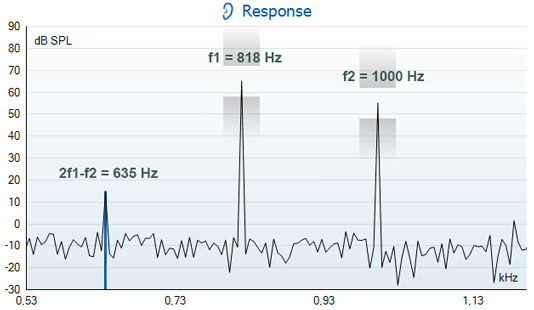 DP response graph with dB SPL as a function of kilohertz. f1 is at 818 hertz. f2 is at 1000 hertz. Thus, 2f1 minus f2 is 635 hertz.