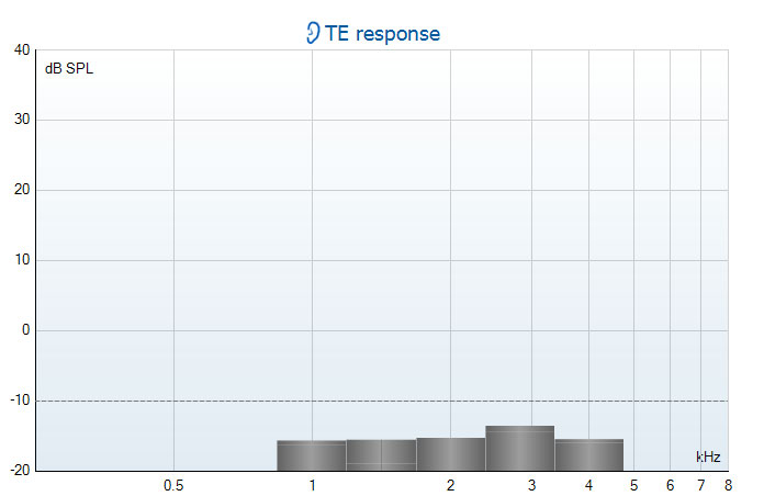 TE response graph with dB SPL as a function of kilohertz. All frequency bands are below the noise floor of minus 10 dB SPL, hovering around minus 15 dB SPL.