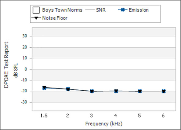 From 1.5 to 6 kilohertz, the noise floor ranges between minus 15 to minus 20 dB SPL.