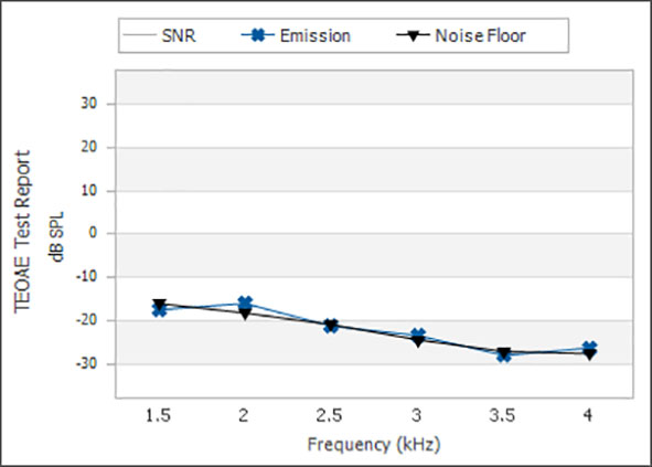 From 1.5 to 6 kilohertz, the noise floor ranges between minus 15 to minus 30 dB SPL.