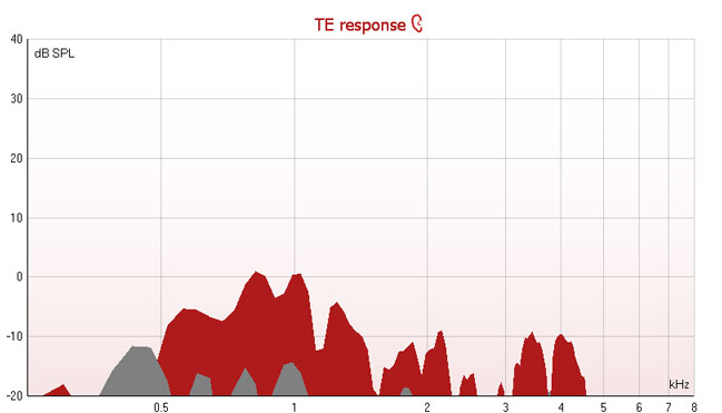 TE response graph with dB SPL as a function of kilohertz. The noise values are grey and the TEOAE responses are red, both visualized as a continuous, mountain-like range.