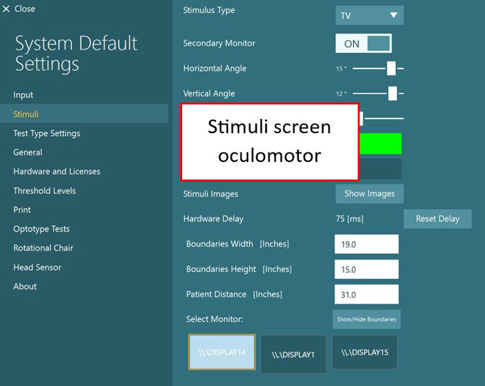 The following options are available: stimulus type, secondary monitor, horizontal angle, vertical angle, stimuli images, hardware delay, boundaries width, boundaries height, patient distance, and select monitor.