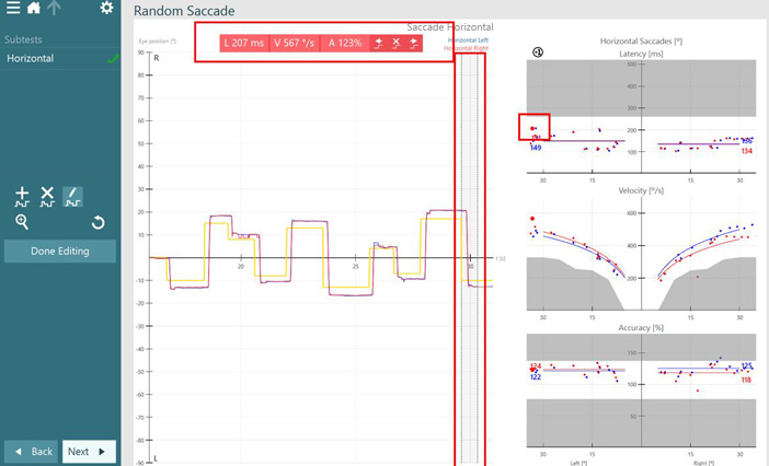 Results overview for horizontal saccade test. Red and blue curves for right and left eye movements follow the yellow curve for target position smoothly and quickly. Graphs for latency, velocity, and accuracy indicate normal results, with results located in the white, normal regions, and not in the grey, abnormal regions. The user has selected a data point with a latency of 207 milliseconds, a velocity of 567 degrees per second, and an accuracy of 123 %. In the velocity graph, it appears as an outlier.