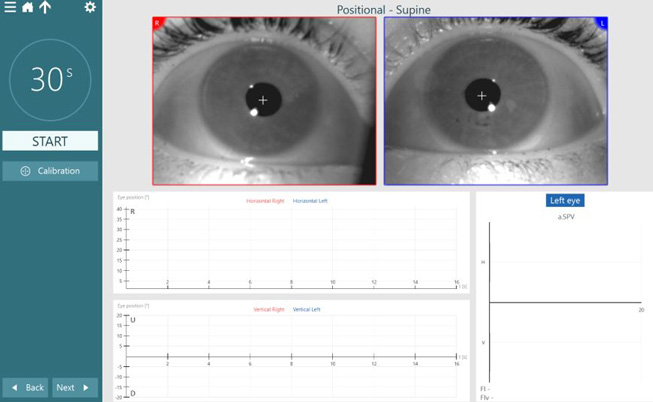 Supine positional test screen. The patient’s eyes are open and ready for recording.