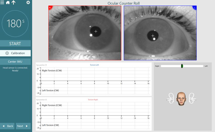 Ocular Counter Roll test screen, displaying eye video images, 3D head model, and torsional data plots. To the left, the user can start, calibrate, or center IMU. Calibration is highlighted white to show that this should be done before testing.