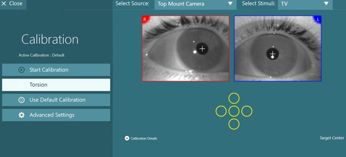 Calibration screen, showing eye video images, calibration points, source, stimuli, and other options. To the left, the user can start the calibration, use the default calibration, and access advanced settings. Torsion calibration is highlighted in white as the next step.