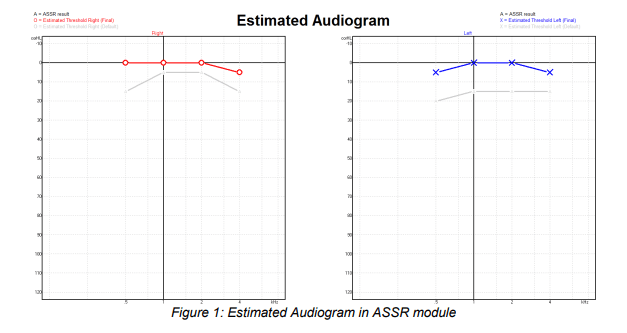 Estimated audiograms for right and left ears, showing estimated thresholds between 0-5 dB eHL for all frequencies.