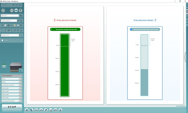 Screenshot of Probe Placement Indicator in the Affinity Suite. The bar for the right ear is green, showing that the probe tube insertion depth is correct. The bar for the left ear shows the probe tube insertion depth is incorrect.