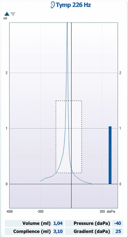 Ear canal volume of 1.04 ml, compliance of 3.10 ml, pressure of minus 40 daPa, and gradient of 25 daPa.