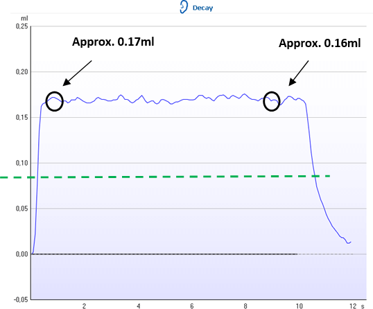 Positively displayed acoustic reflex. The deflection value at onset is about 0.17 ml. The deflection value after 10 seconds is about 0.16 ml. Thus, the response does not cross the 50% threshold at about 0.085 ml, which is visible by a green dotted line.