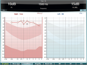 Pure tone audiometry software screen. An audiogram has only been recorded in the right ear, which is between 0 dB HL and 15 dB HL for all frequencies.