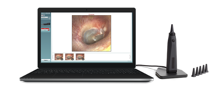 Laptop with video otoscopy software, Viot™ and speculums.