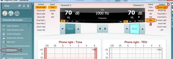 TEN test in Diagnostic Suite