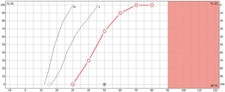 another name for speech detection threshold