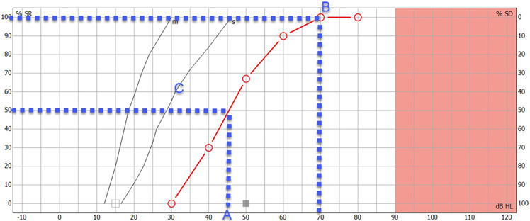 Point A is at about 45 dB HL. Point B is at about 70 dB HL.