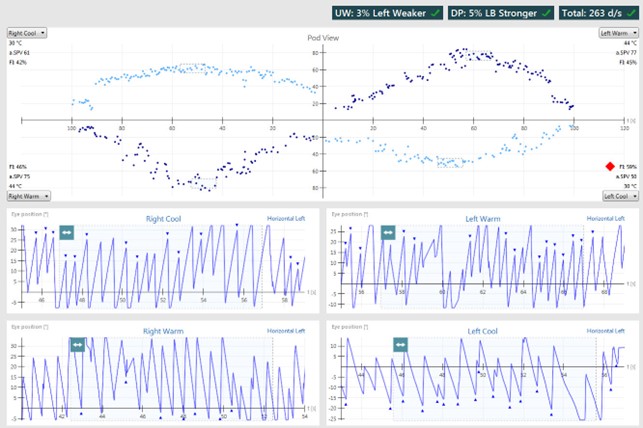 Results overview with pod and eye position views for right cool, right warm, left warm, and left cool irrigations. Unilateral weakness of 3%, left weaker. Directional preponderance of 5%, left-beating nystagmus stronger. For right cool, the average slow phase velocity is 61 and the fixation index is 42%. For right warm, the average slow phase velocity is 75 and the fixation index is 46%. For left warm, the average slow phase velocity is 77 and the fixation index is 45%. For left cool, the average slow phase velocity is 50 and the fixation index is 59%.