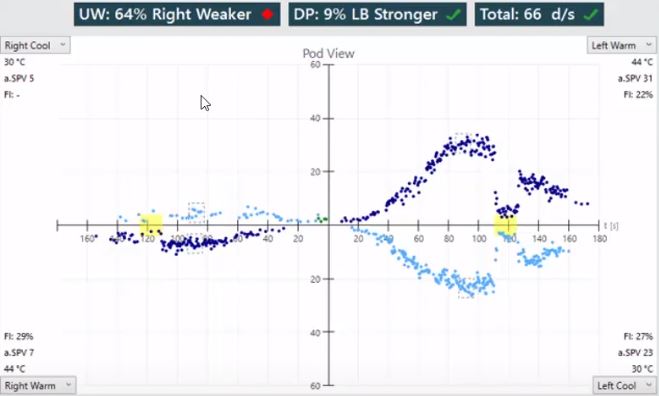 Results overview with pod view for right cool, right warm, left warm, and left cool irrigations. Unilateral weakness of 64%, right weaker. Directional preponderance of 9%, left-beating nystagmus stronger. For right cool, the average slow phase velocity is 5 with no calculated fixation index. For right warm, the average slow phase velocity is 7 and the fixation index is 29%. For left warm, the average slow phase velocity is 31 and the fixation index is 22%. For left cool, the average slow phase velocity is 23 and the fixation index is 27%.