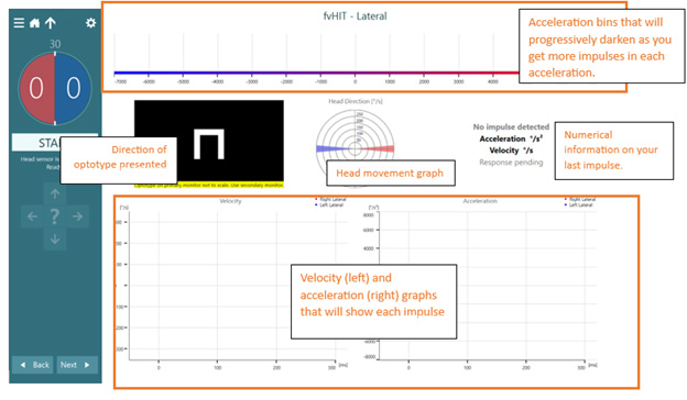 The test screen includes the following. Acceleration bins that will progressively darken as you get more impulses in each acceleration. Direction of optotype. Head movement graph. Numerical information on your last impulse. Finally, velocity and acceleration graphs that will show each impulse.
