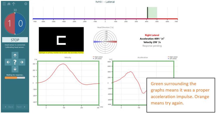 Green surrounding the velocity and acceleration graphs means it was a proper acceleration impulse.