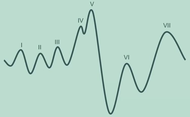Automated cortical auditory evoked potentials threshold estimation in neonates