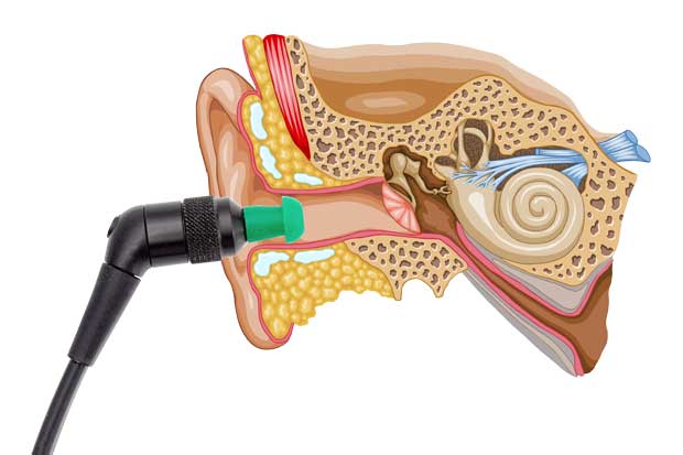 Acoustic Immittance in children without otoacoustic emissions