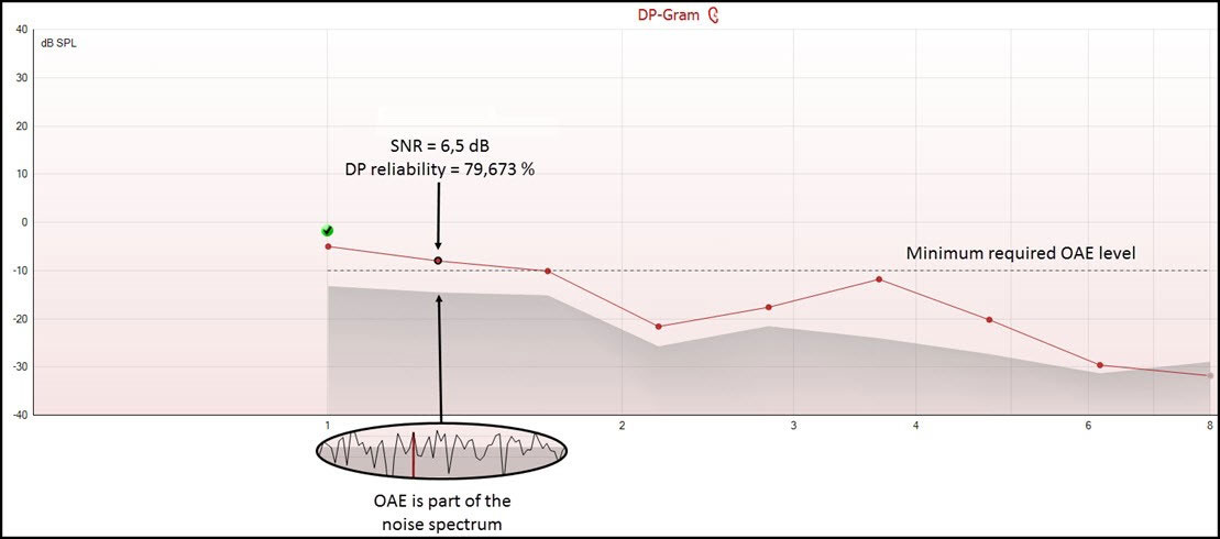 DPOAE response with a six point five dB SNR and a reliability of 79 percent
