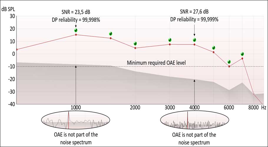 DPOAE response with a reliability of almost one hundred percent