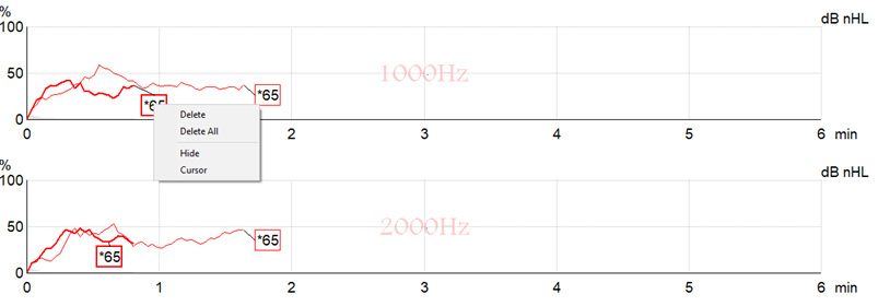 ASSR curves for the 65 dB nHL intensity. One of the curves ends short of one minute, whereas the other ends short of two minutes. The user has right clicked the shorter measurement with the options to ‘Delete’, ‘Delete All’, ‘Hide’, or ‘Cursor’.