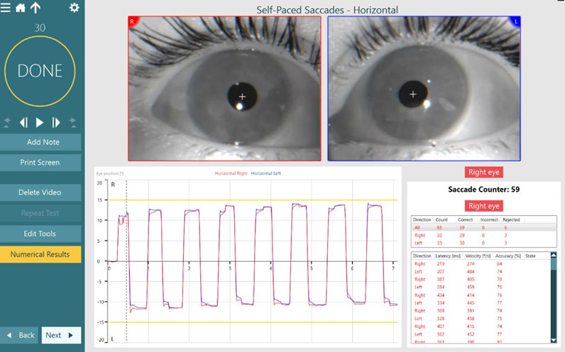 In this example, the saccade counter is displaying the results for the right eye. There are two data charts. The first has five columns which sum up the total amount of saccades when it comes to direction, count, correct, incorrect, and rejected. The second chart displays the results for each individual saccade, including direction, latency, velocity, and accuracy.