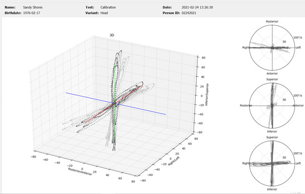 Three-dimensional representation of head movements in the posterior/anterior, right/left, and interior/superior planes.