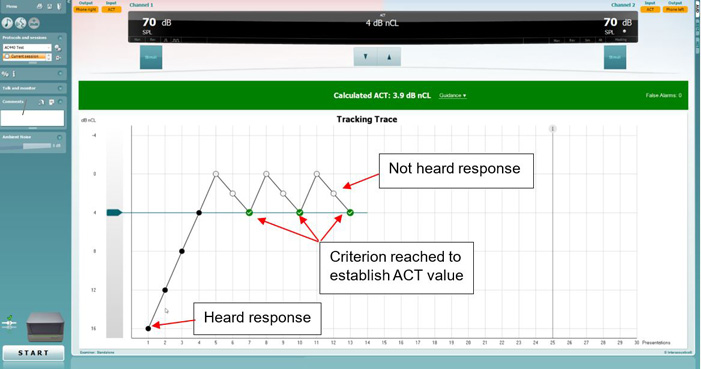 ACT test screen in the software. The patient has a calculated ACT value of 3 point 9 dB nCL. The graph has dB nCL as a function of presentations. The presentations at 16, 12, 8, and 4 dB nCL were all heard on the first try. Following, the patient was unable to hear the presentations at 0 and 2 dB nCL. The patient then hears the stimulus correctly at 4 dB nCL. This process repeats itself two times, leaving the patient with an ACT threshold value of 3 point 9 dB nCL.