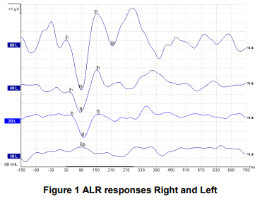 Automated cortical auditory evoked potentials threshold estimation in  neonates