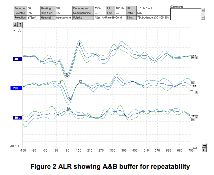 Simulated Human Evoked Response Audiometry (SimHERA)