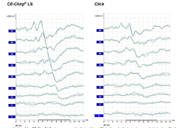 Eclipse Testing | Interacoustics