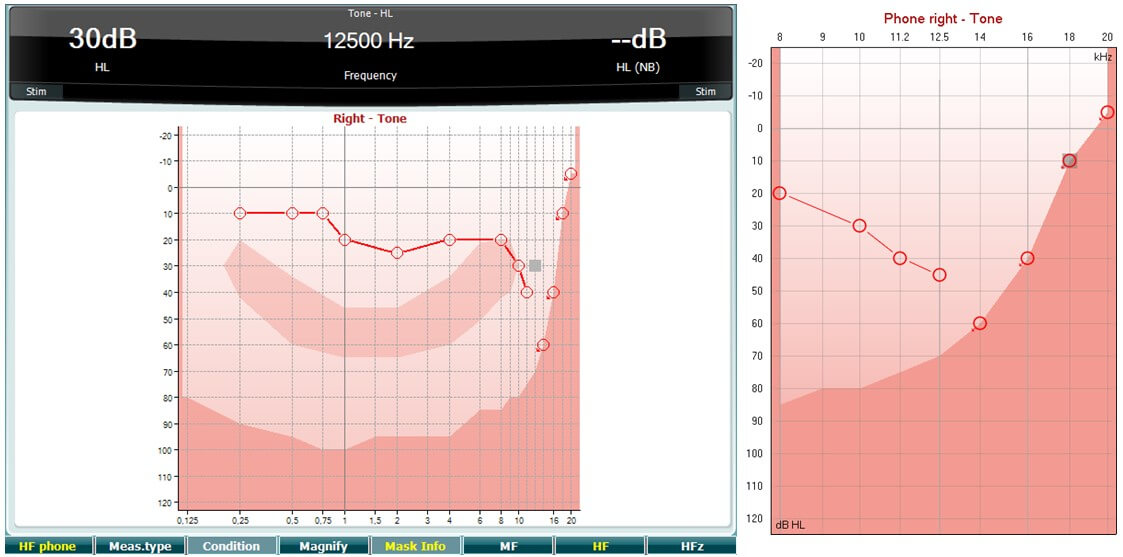 Audio Frequency Spectrum, Teetiv.com