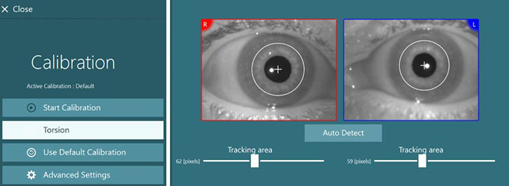Images of right and left eyes. For both eyes, a small cross is at the center of the pupil, encircled by a white circle. The tracking area for the right eye is 62 pixels, and 59 pixels for the left eye. A button is available labeled ‘Auto Detect’. To the left there are four options available: start calibration, torsion, use default calibration, and advanced settings.