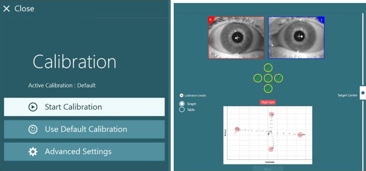 Right and left eyes displayed, with five green checkmarks below for the following positions: center, left, up, right, and down. Visible as an almost perpendicular cross relative to the center dot in a graph below.