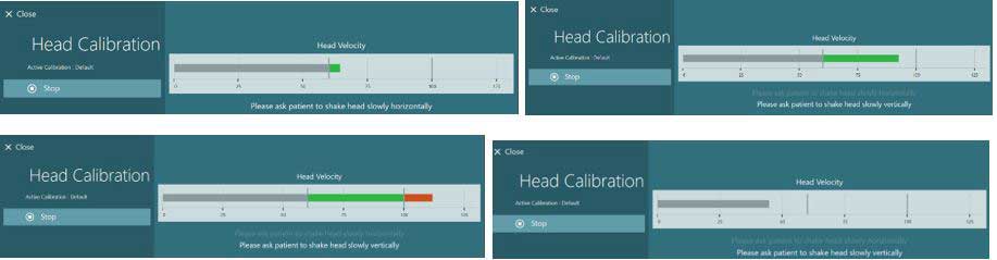 Four identical head calibration graphs, with head velocity in degrees as the sole, x-axis value. Two of the graphs have a green peak, indicating a correct head velocity. One has a red peak, indicating a too fast head velocity. The final is grey, indicating a too slow head velocity.