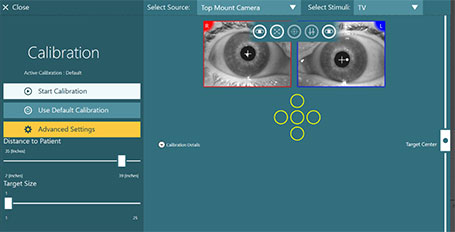 Calibration screen with no eye positions completed. Options to the left include start calibration, use default calibration, distance to patient, and target size. The selected source is top mount camera. The selected stimulus is TV.