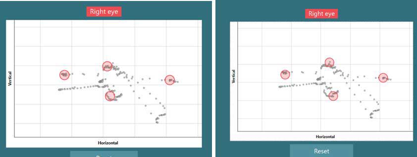 Graph representation of the eye calibration. Red circles are placed by the software in the left, up, right, and down positions for where it has detected a cluster of eye positions.