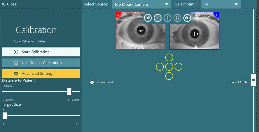 VisualEyes™ Calibration Procedures Interacoustics