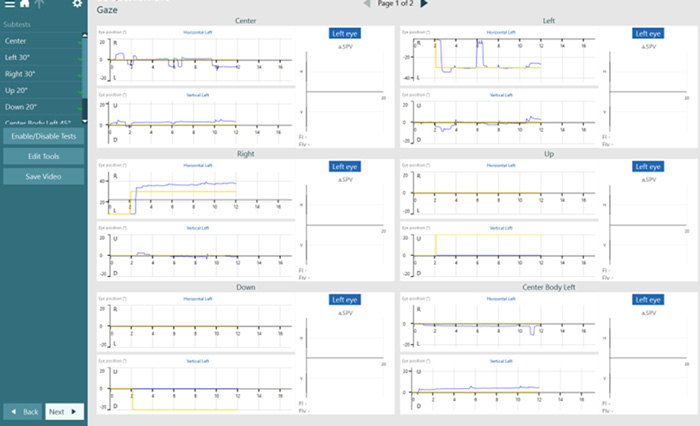 Graphs with eye position in degrees as a function of time for the various gaze positions.