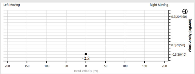 Graph with visual acuity (logarithmic) as a function of head velocity. The patient's static visual acuity score is minus 0.3 at a head velocity of 0 degrees per second.