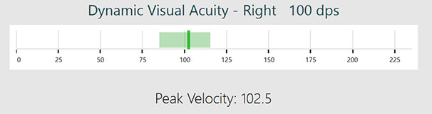 Velocity bar for DVA right, 100 dps. The velocity bar is a single-axis, horizontal graph, ranging from 0 to 225 degrees per second. The proper head speed range is marked with a green area and is approximately between 85 to 115 degrees per second. The head speed in this instance is 102.5, indicated by a green, solid line.